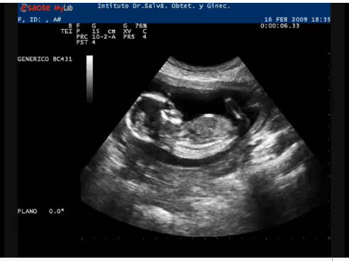 embarazo semana 19